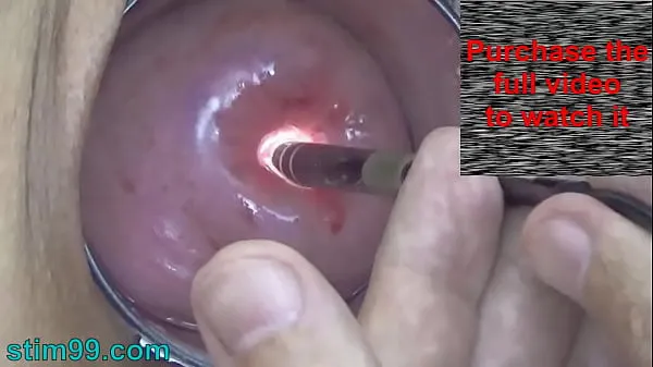 Ny Endoscope Camera inside Cervix Cam into Pussy Uterus fint rør