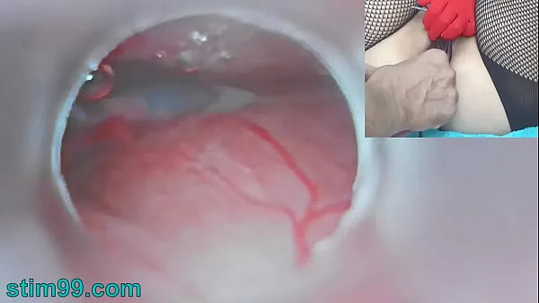 新型Uncensored Japanese Insemination with Cum into Uterus and Endoscope Camera by Cervix to watch inside womb细管