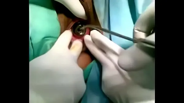 Novo how to reject a GLASSY BULB from vagina tubo fino